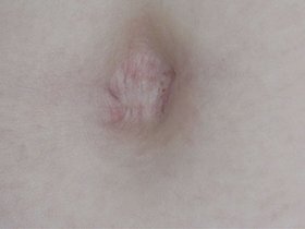 300人のへそ 2　サンプル画像08